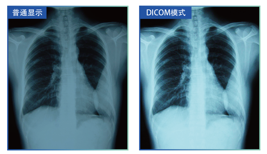 DICOM 模拟模式.png